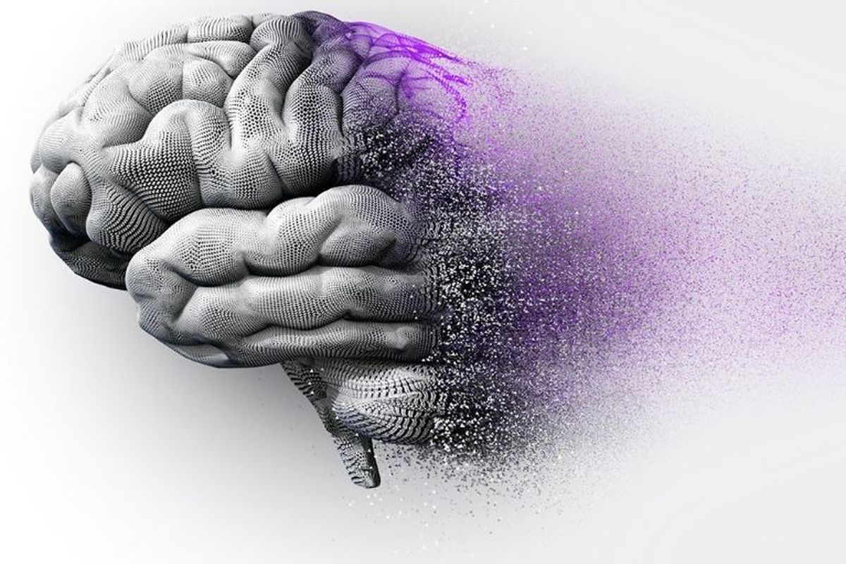 علائم آلزایمر - مغز