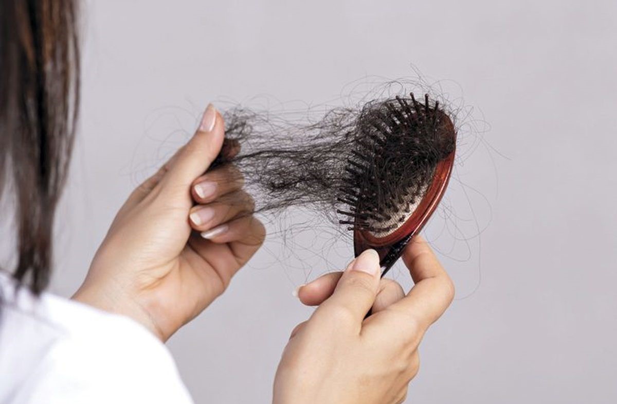 درمان ریزش مو - درمان ریزش مو با رزماری