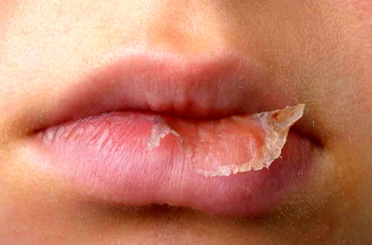 اسکراب لب - درمان خشکی لب با خمیر دندان