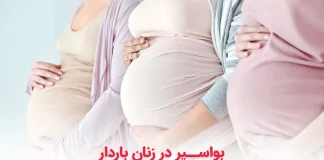 بواسیر در بارداری