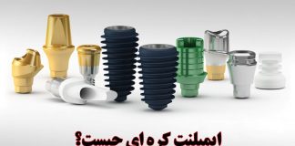 ایمپلنت کره ای چیست