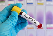 راهنمای کامل آزمایش خون بارداری بتا + تفسیر جواب راهنمای کامل آزمایش خون بارداری بتا