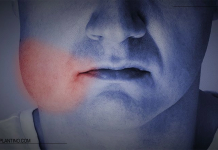 سریعترین راه های درمان ورم بعد از ایمپلنت دندان