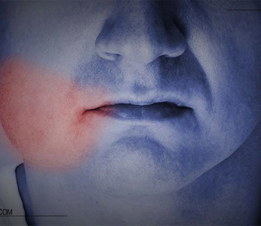 سریعترین راه های درمان ورم بعد از ایمپلنت دندان